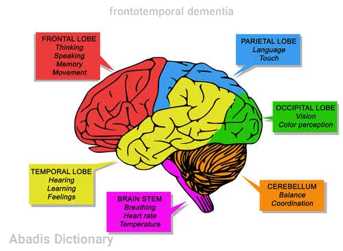 frontotemporal dementia
